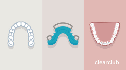 Illustration comparing clear plastic, Hawley wire, and permanent retainers, highlighting differences in style, visibility, and usage.