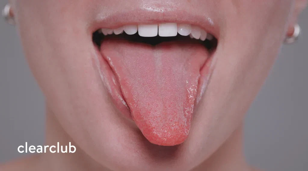 Close-up of a tongue being examined for signs of irritation or allergic reaction.