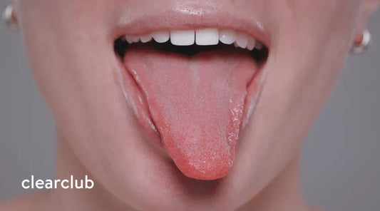 Close-up of a tongue being examined for signs of irritation or allergic reaction.