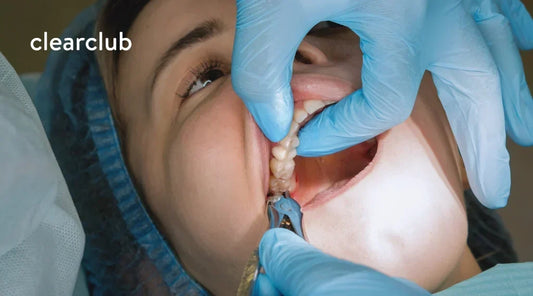 Woman undergoing removal of a decayed upper wisdom tooth
