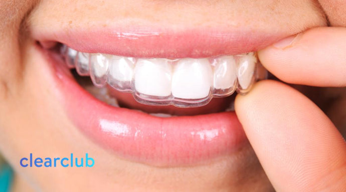 Unveiling the Invisible: The Power of Clear Retainers