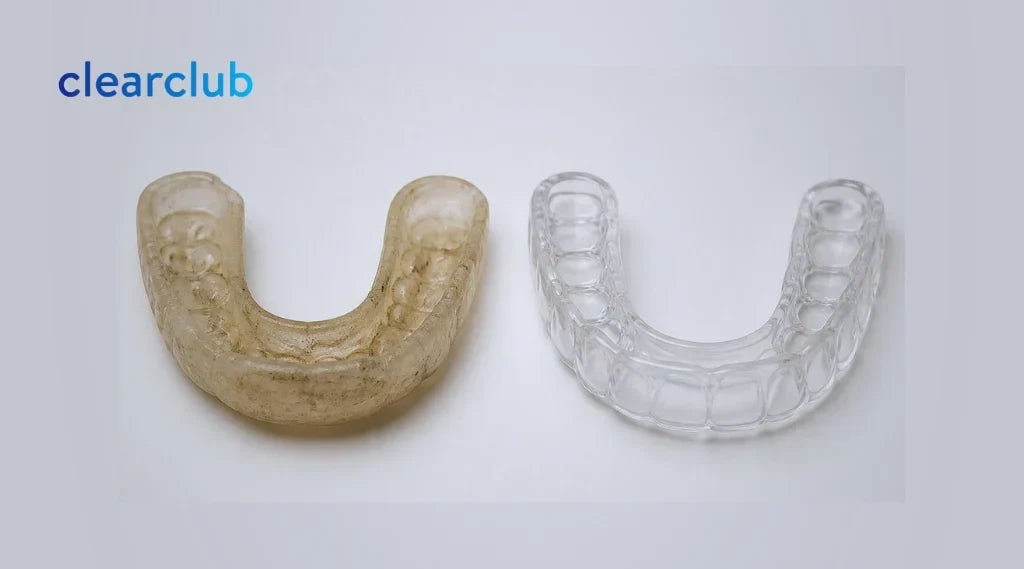 Comparison of two dental guards showing an old yellowed guard with buildup on the left and a clean, clear night guard on the right.