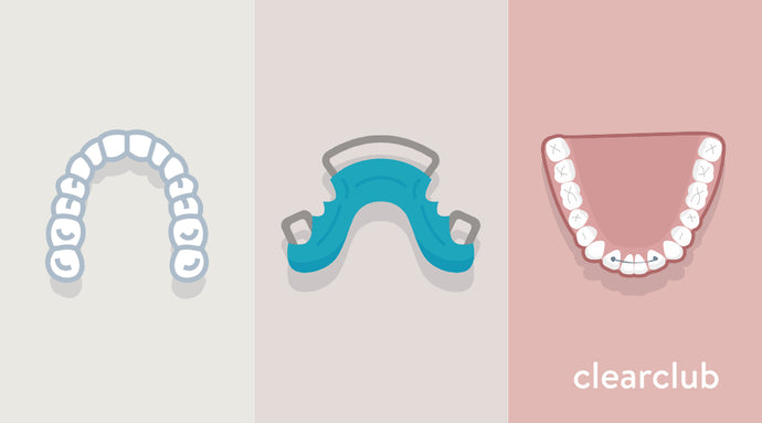 Clear vs. Hawley vs. Permanent Retainers: Which One Fits You Best?