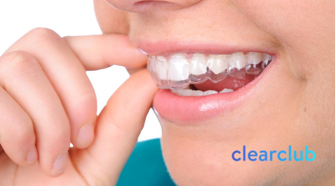 ClearClub: Your Premier Destination for Retainers Online