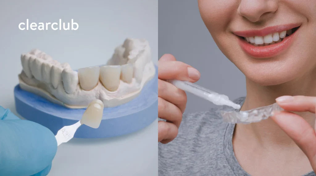 A veneer cap being fitted on teeth and whitening gel applied to a tray. 