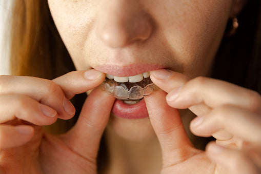 Woman wearing the best custom night mouth guard for teeth grinding, clenching and TMJ