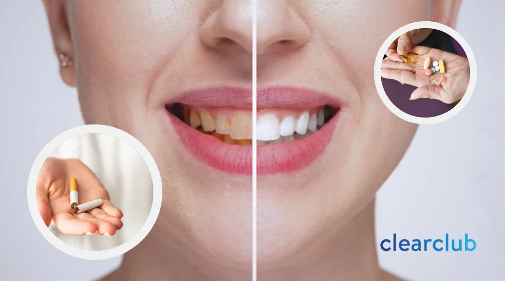 Comparison image showing stained teeth, cigarettes, and prescription drugs as potential causes